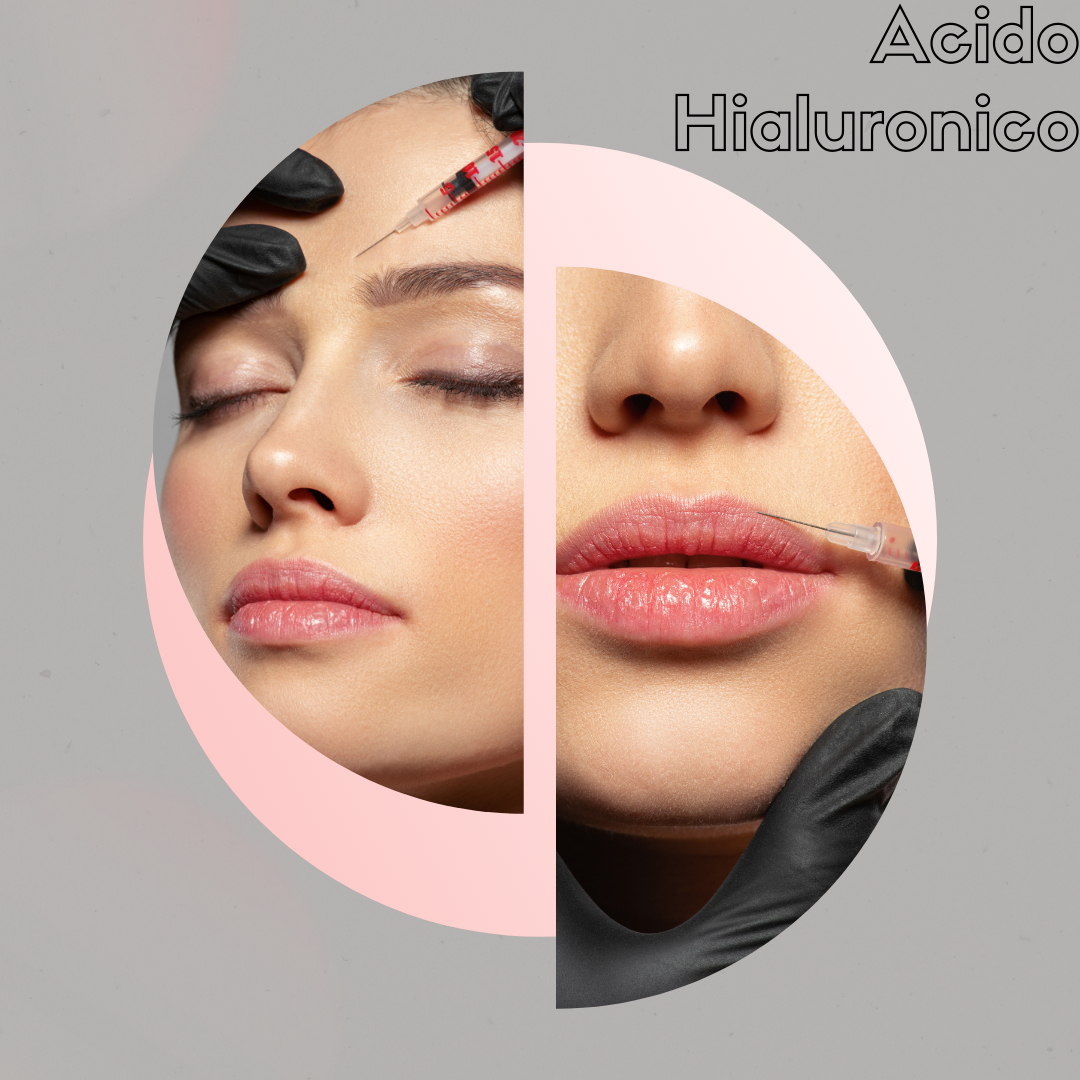 ACIDO HIALURONICO